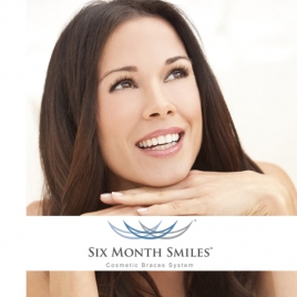 SIX MONTH SMILES – greitas dantų tiesinimas